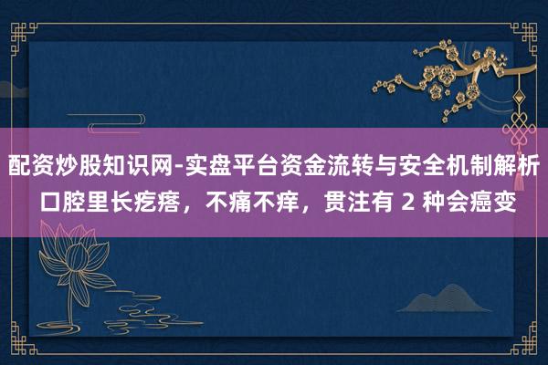 配资炒股知识网-实盘平台资金流转与安全机制解析 口腔里长疙瘩，不痛不痒，贯注有 2 种会癌变